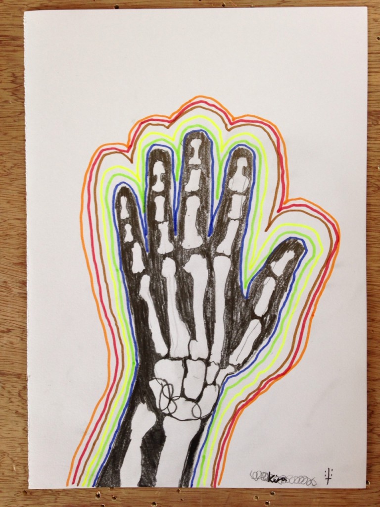 HAND_XRAY_01