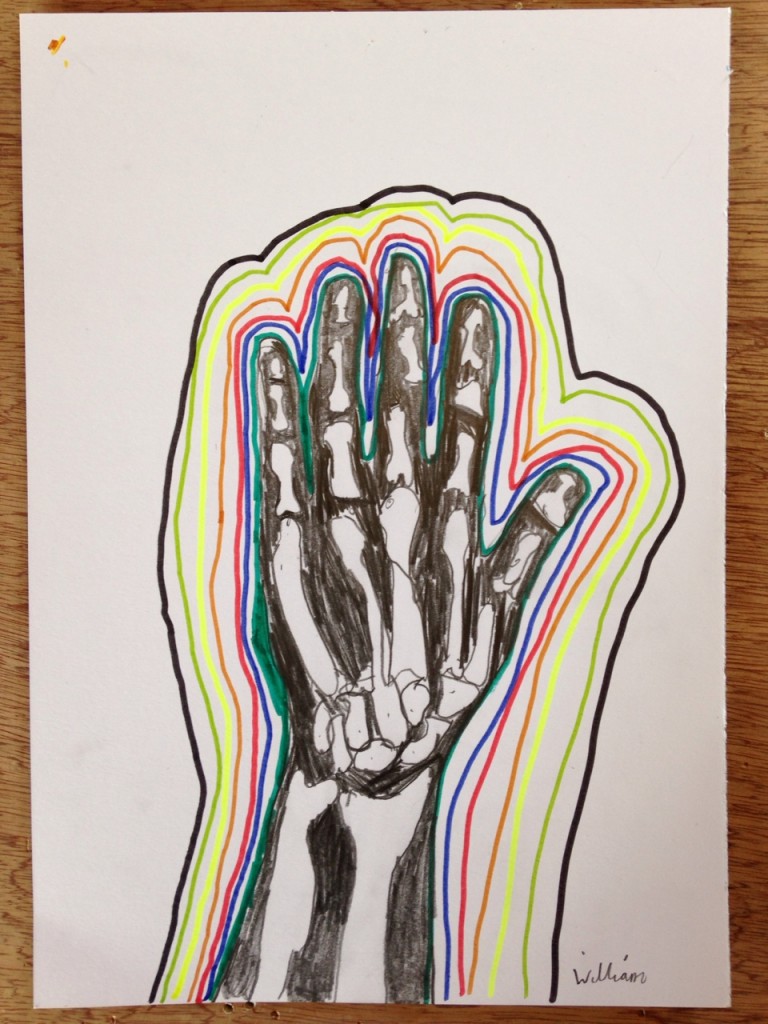 HAND_XRAY_02