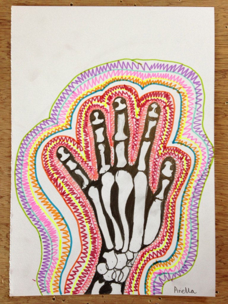 HAND_XRAY_03