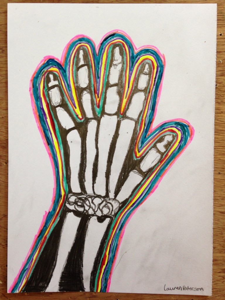 HAND_XRAY_04