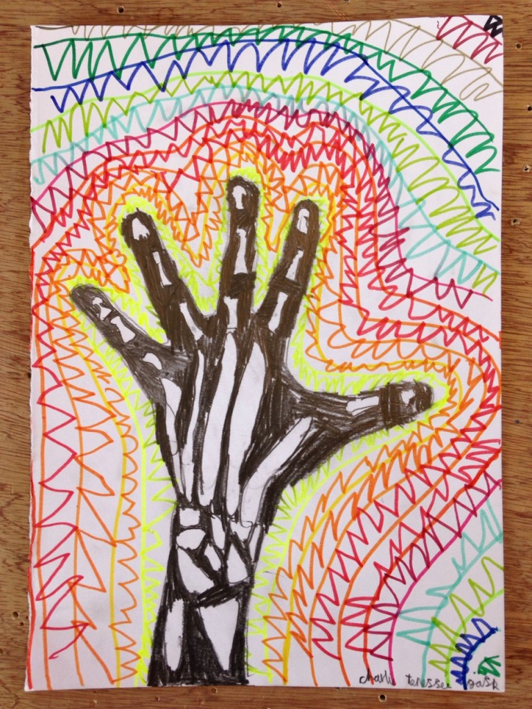 HAND_XRAY_05