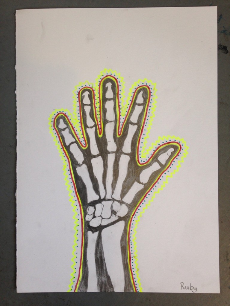 HAND_XRAY_07