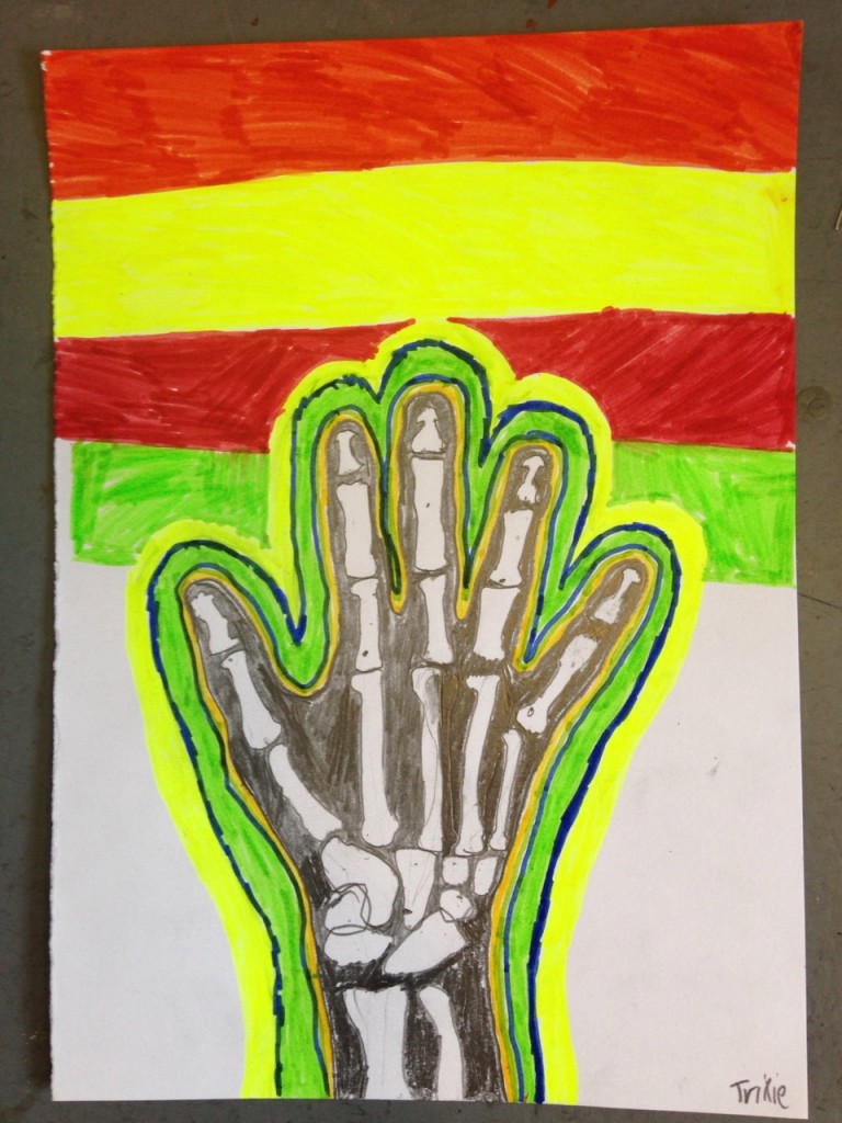 HAND_XRAY_08